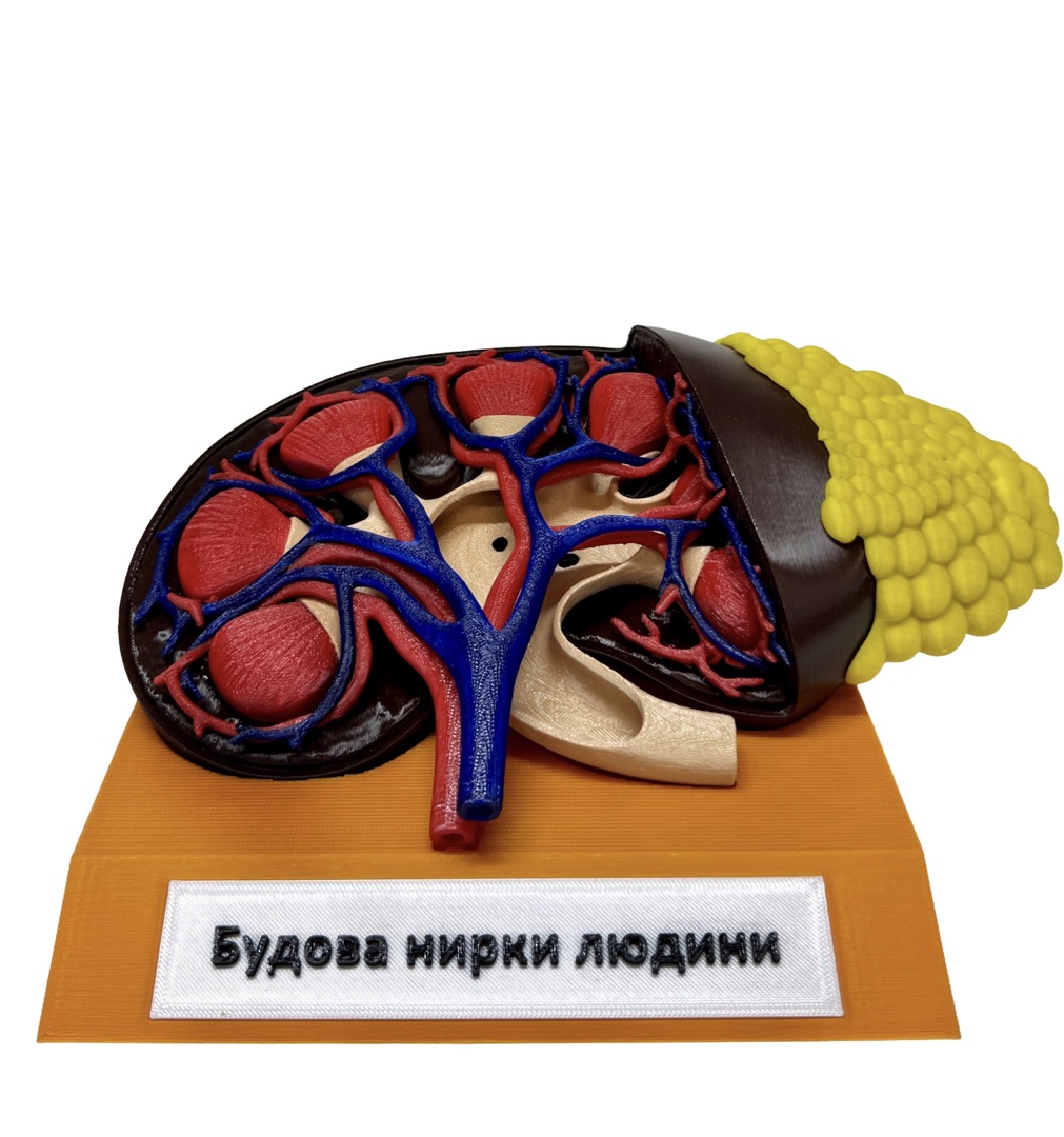 Нирка